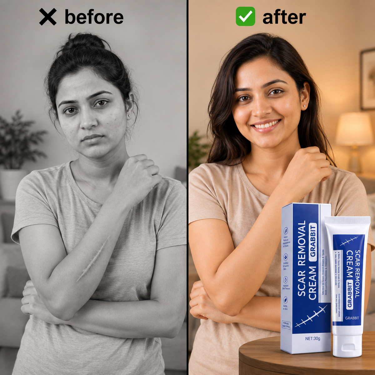 ScarAway™ Scar Removal Cream (Pack of 2)