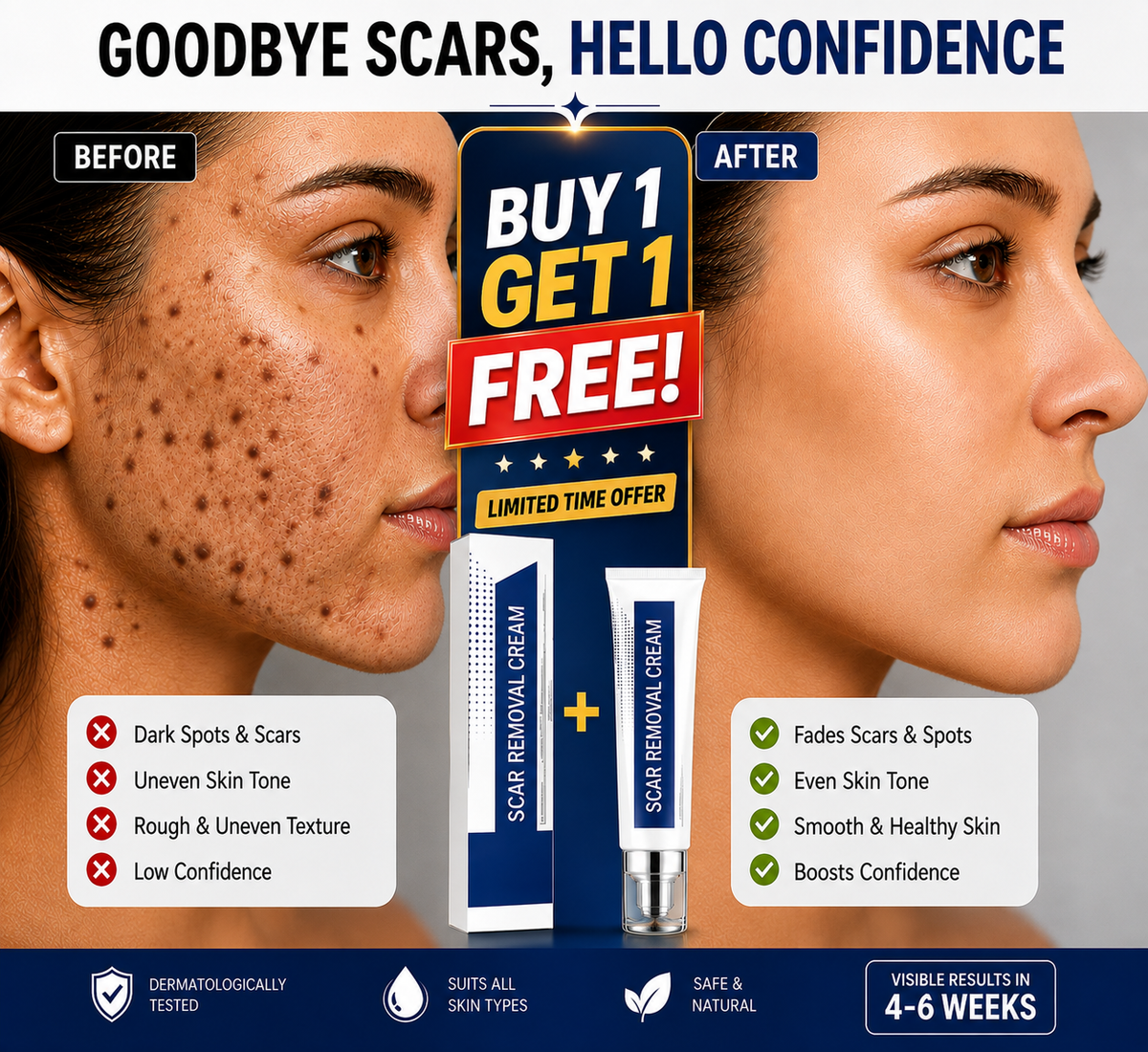 ScarAway™ Scar Removal Cream (Pack of 2)